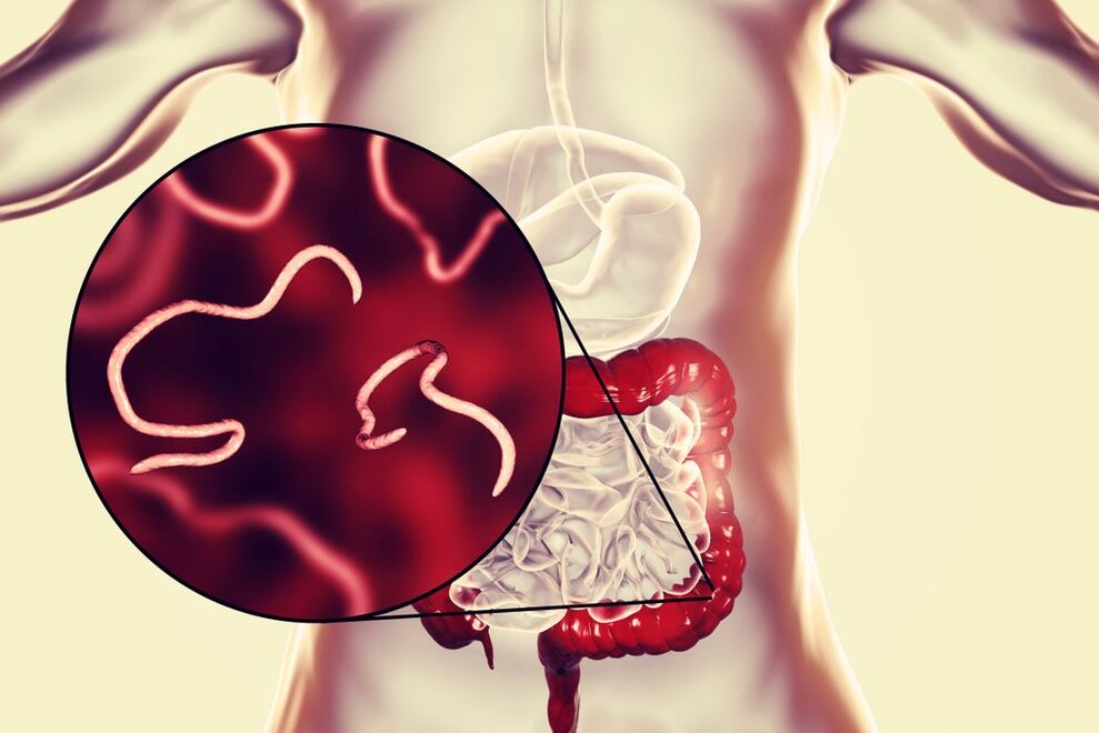 gusanos en los intestinos humanos